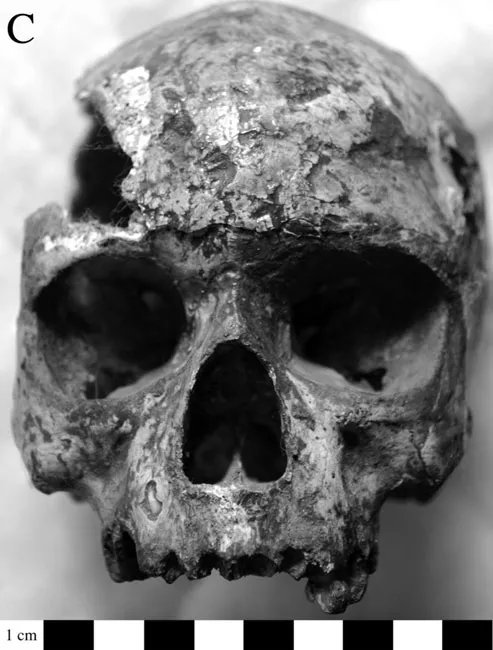 Infection Disease and Biological Processes at the End of the Indus Civilization 