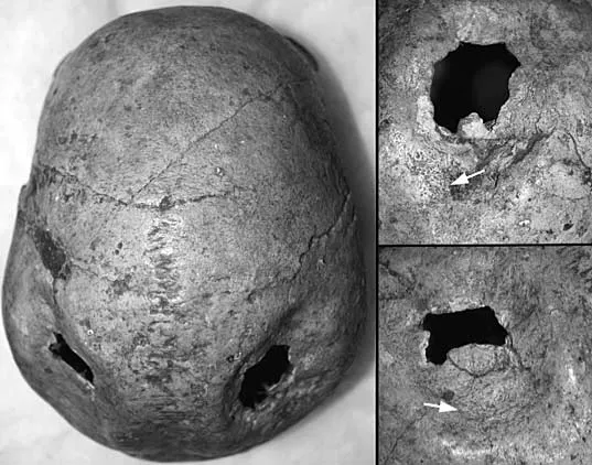 Trauma and Social Differentiation at Harappa