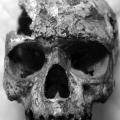 Infection Disease and Biological Processes at the End of the Indus Civilization 