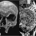Skeletal remains from Balithal, Rajasthan