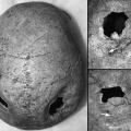 Trauma and Social Differentiation at Harappa