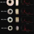 Four Small White Beads from Kotada Bhadli and their XRD Spectra